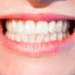 Ładne nienaganne zęby także godny podziwu uroczy uśmiech to powód do płenego uśmiechu.